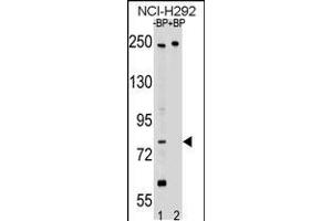 Western blot analysis of APPL2 Antibody Pab pre-incubated without(lane 1) and with(lane 2) blocking peptide in NCI-H292 cell line lysate.