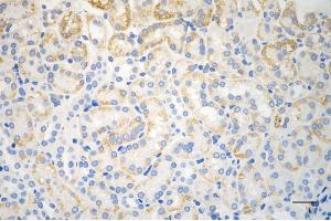 Immunohistochemistry was performed on paraffin-embedded mouse kidney using BAX antibody (ABIN7797748), 1:200).