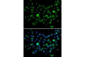 Immunofluorescence analysis of A549 cell using MCM10 antibody.