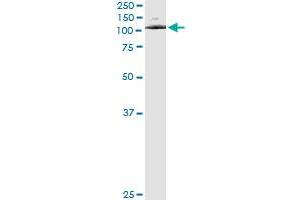 Immunoprecipitation of ATP2C1 transfected lysate using anti-ATP2C1 monoclonal antibody and Protein A Magnetic Bead , and immunoblotted with ATP2C1 MaxPab rabbit polyclonal antibody. (ATP2C1 antibody  (AA 119-269))