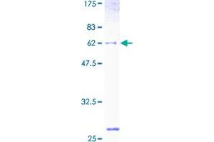 GALE Protein (AA 1-348) (GST tag)