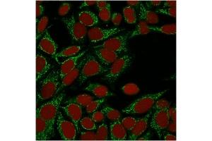 Confocal immunofluorescence image of HeLa cells using Galectin-1 Monospecific Mouse Monoclonal Antibody (GAL1/1831). (LGALS1/Galectin 1 antibody  (AA 12-108))