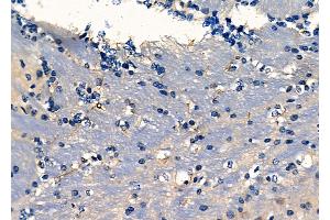 ABIN6261819 and ABIN6278083 at 1/100 staining Mouse brain tissue by IHC-P. (Fascin antibody  (C-Term))