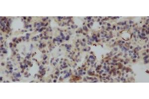 Immunohistochemistry of paraffin-embedded Rat lung using IL4 Polyclonal Antibody at dilution of 1:50 (IL-4 antibody)