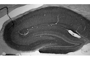 Adult rat hippocampus immunohistochemistry.