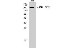 Western Blotting (WB) image for anti-PTK2B Protein tyrosine Kinase 2 beta (PTK2B) (pTyr579) antibody (ABIN3182689) (PTK2B antibody  (pTyr579))