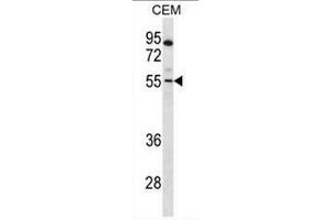 PAX7 Antibody (Center) western blot analysis in CEM cell line lysates (35µg/lane). (PAX7 antibody  (Middle Region))