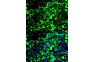 Immunofluorescence analysis of HeLa cell using TPM1 antibody. (Tropomyosin antibody  (AA 1-245))