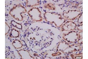 Formalin-fixed and paraffin embedded human kidney labeled with Anti-ATG101 Polyclonal Antibody, Unconjugated  at 1:300 followed by conjugation to the secondary antibody and DAB staining.