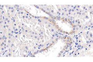 Detection of PARK7 in Human Kidney Tissue using Monoclonal Antibody to Parkinson Disease Protein 7 (PARK7) (PARK7/DJ1 antibody  (AA 2-189))