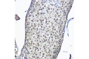 Immunohistochemistry of paraffin-embedded mouse testis using Casein Kinase 2 beta (Casein Kinase 2 beta (CSNK2B)) Rabbit pAb  at dilution of 1:100 (40x lens). (CSNK2B antibody  (AA 1-215))