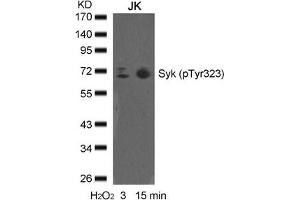 Western blot analysis of extracts from JK cells untreated or treated with H2O2 for the indicated times, using syk(phospho-Tyr323) Antibody. (SYK antibody  (pTyr323))
