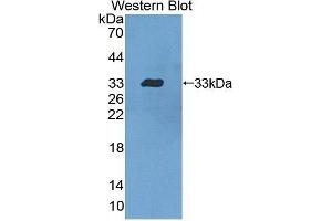 Western Blotting (WB) image for anti-Signal Transducer and Activator of Transcription 5B (STAT5B) (AA 497-749) antibody (ABIN3206169) (STAT5B antibody  (AA 497-749))