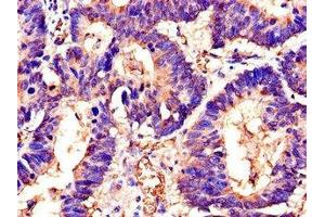 Immunohistochemistry (IHC) image for anti-SWI5 Recombination Repair Homolog (SWI5) (AA 54-112) antibody (ABIN7150297)