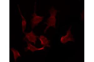 ABIN6267440 staining NIH-3T3 by IF/ICC. (RPS6KB1 antibody  (pSer411))