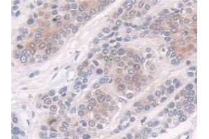 Immunohistochemistry (IHC) image for anti-Cellular Retinoic Acid Binding Protein 2 (CRABP2) (AA 1-138) antibody (ABIN7435991)