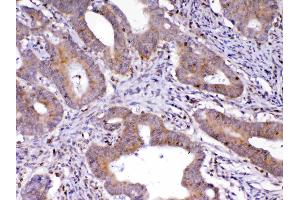 IHC analysis of Cdc20 using anti-Cdc20 antibody . (CDC20 antibody)