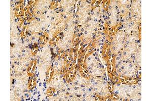 anti-Leucine Rich Repeat Neuronal 3 (LRRN3) antibody