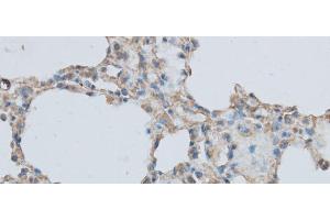 Immunohistochemistry of paraffin-embedded Rat lung using MMP1 Polyclonal Antibody at dilution of 1:50 (MMP1 antibody)