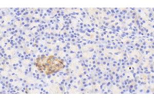 Immunohistochemistry (IHC) image for anti-Guanine Deaminase (GDA) (AA 1-454) antibody (ABIN7441532)