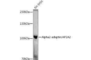 Western blot analysis of extracts of SH-SY5Y cells, using Alph-adaptin/ antibody (ABIN6130980, ABIN6136955, ABIN6136957 and ABIN6221039) at 1:1000 dilution. (AP2A2 antibody  (AA 590-939))