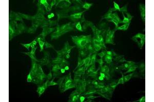 Image no. 9 for anti-Budding Uninhibited By Benzimidazoles 1 Homolog beta (Yeast) (BUB1B) antibody (ABIN1496995) (BUB1B antibody)