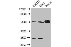 Western Blot Positive WB detected in: NIH/3T3 whole cell lysate, K562 whole cell lysate, Mouse brain tissue All lanes: TUBA4A antibody at 3 μg/mL Secondary Goat polyclonal to rabbit IgG at 1/50000 dilution Predicted band size: 50, 49 kDa Observed band size: 50, 24 kDa (TUBA4A antibody  (AA 20-183))