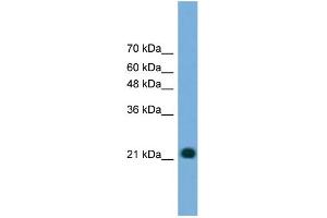 WB Suggested Anti-MYL4 Antibody Titration: 0. (MYL4 antibody  (N-Term))