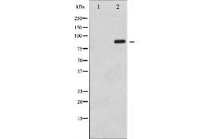 Western blot analysis of STAT6 phosphorylation expression in IL-4 treated HeLa whole cell lysates,The lane on the left is treated with the antigen-specific peptide. (STAT6 antibody  (pTyr641))