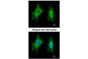 ICC/IF Image Immunofluorescence analysis of paraformaldehyde-fixed HeLa, using PSPH, antibody at 1:200 dilution. (PSPH antibody)