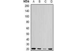 Western blot analysis of Centrin-1 expression in Jurkat (A), Hela (B), mouse testis (C), rat testis (D) whole cell lysates.