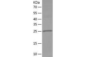 Western Blotting (WB) image for Pyrophosphatase (Inorganic) 1 (PPA1) (AA 1-289) protein (His tag) (ABIN7124715) (Pyrophosphatase (Inorganic) 1 (PPA1) (AA 1-289) protein (His tag))