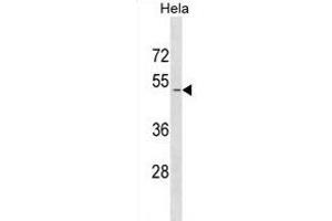 SD1 Antibody (N-term) (ABIN1881815 and ABIN2839003) western blot analysis in Hela cell line lysates (35 μg/lane). (SMAD1 antibody  (N-Term))
