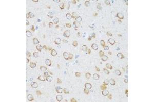 Immunohistochemistry of paraffin-embedded mouse brain using DHODH antibody. (DHODH antibody  (AA 116-395))