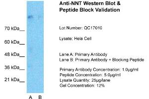 Host:  Rabbit  Target Name:  NNT  Sample Type:  Hela Whole cell  Lane A:  Primary Antibody  Lane B:  Primary Antibody + Blocking Peptide  Primary Antibody Concentration:  1ug/ml  Peptide Concentration:  5ug/ml  Lysate Quantity:  25ug/lane/Lane  Gel Concentration:  0. (NNT antibody  (N-Term))