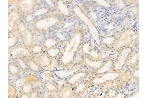 ABIN6256071 and ABIN6267492 at 1/100 staining human normal kidney tissue by IHC-P.