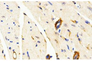 Immunohistochemistry of paraffin-embedded Mouse heart using LAMP3 Polyclonal Antibody at dilution of 1:200 (40x lens). (LAMP3 antibody)