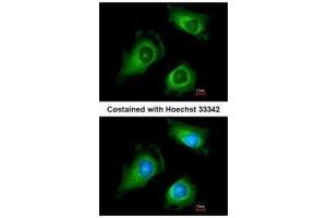 ICC/IF Image Immunofluorescence analysis of methanol-fixed HeLa, using Fukutin, antibody at 1:200 dilution. (Fukutin antibody)