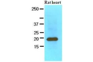 The extracts of Rat heart (60 ug) were resolved by SDS-PAGE, transferred to nitrocellulose membrane and probed with anti-human MYL2 (1:1000). (MYL2 antibody  (AA 1-166))