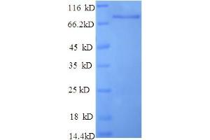 SDS-PAGE (SDS) image for Dipeptidyl-Peptidase 6 (DPP6) (AA 111-859), (Extracellular) protein (His tag) (ABIN4976939)