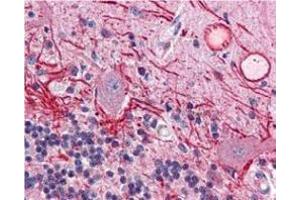 Immunohistochemistry of Mouse anti-AKT pT308 antibody.