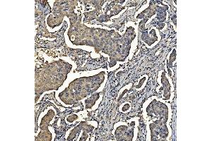 IHC analysis of Aldolase/ALDOA using anti-Aldolase/ALDOA antibody (ABIN7601908). (ALDOA antibody  (AA 50-364))