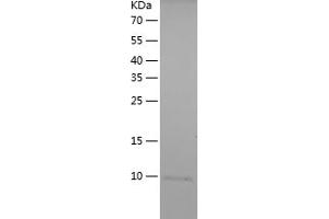 PKC eta Protein (AA 614-674) (His tag)
