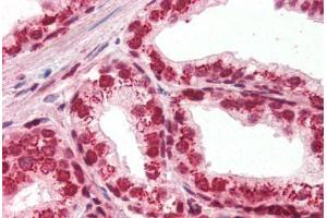 Human Prostate (formalin-fixed, paraffin-embedded) stained with APEX1 antibody ABIN396973 at 1:250 followed by biotinylated goat anti-rabbit IgG secondary antibody ABIN481713, alkaline phosphatase-streptavidin and chromogen. (APEX1 antibody)
