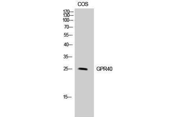 FFAR1 antibody  (Internal Region)