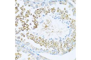Immunohistochemistry of paraffin-embedded mouse testis using DVL1 antibody (ABIN7266796) at dilution of 1:100 (40x lens). (DVL1 antibody  (AA 510-640))