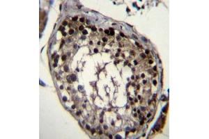 Formalin fixed, paraffin embedded human testis tissue stained with DAZ4 Antibody  followed by peroxidase conjugation of the secondary antibody and DAB staining. (DAZ4 antibody  (Middle Region))