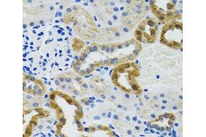 Immunohistochemistry (Paraffin-embedded Sections) (IHC (p)) image for anti-Polymerase (DNA Directed), gamma 2, Accessory Subunit (POLG2) antibody (ABIN7262585)