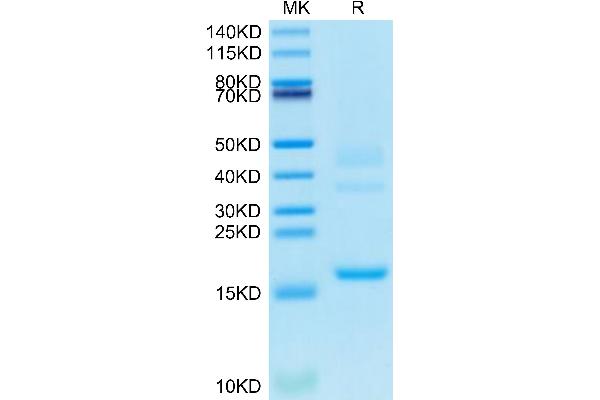 TTR Protein (AA 21-147) (His tag)