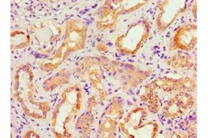 Immunohistochemistry of paraffin-embedded human kidney tissue using ABIN7143106 at dilution of 1:100 (ACTR3B antibody  (AA 189-418))